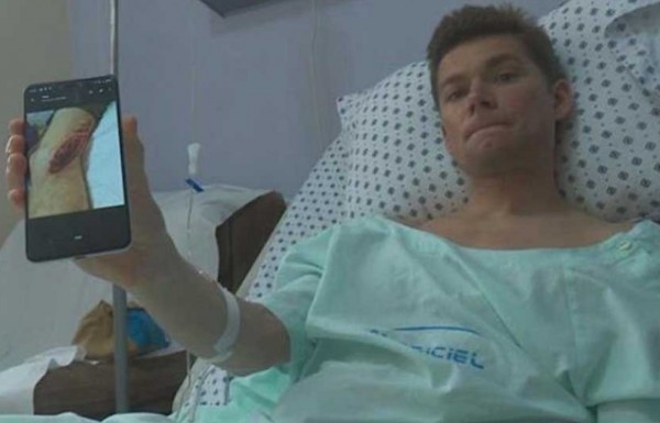 Alex Wilton shark attack.jpg