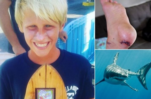Logan Radd shark attack.jpg